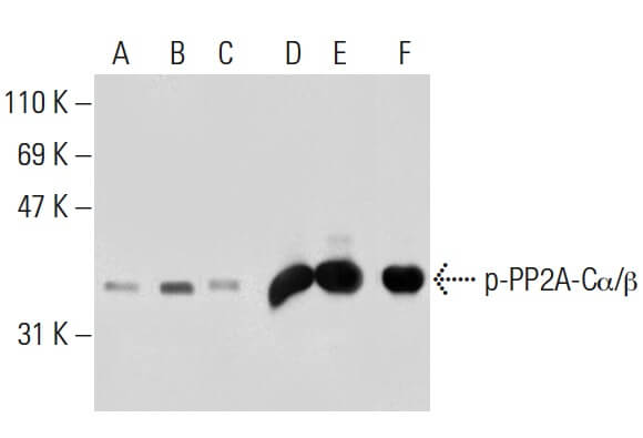 PP2A-Cα/β Antibody (1D6) | SCBT - Santa Cruz Biotechnology