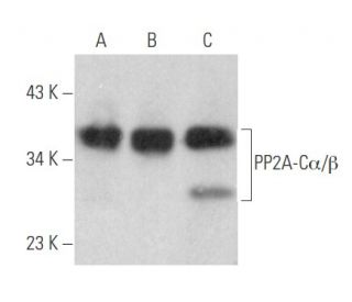 pp2a-calpha-beta-antibody-1d6-