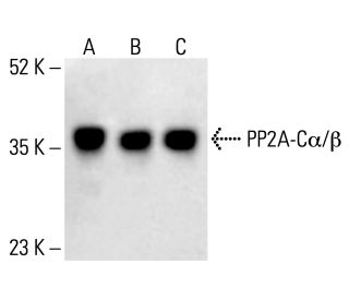PP2A-Cα/β Antibody (1D6) | SCBT - Santa Cruz Biotechnology