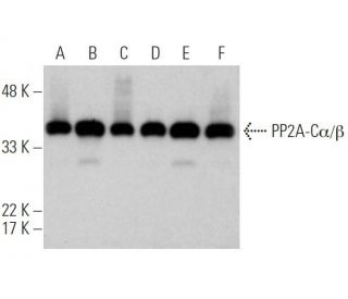 western blotting image from recommended PP2A-C&alpha;/&beta; (1D6) monoclonal antibody replacement. Image 368015