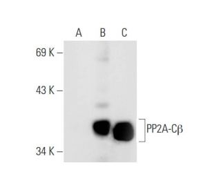 Anti Pp2a Ca B Antibody G 4 Scbt Santa Cruz Biotechnology