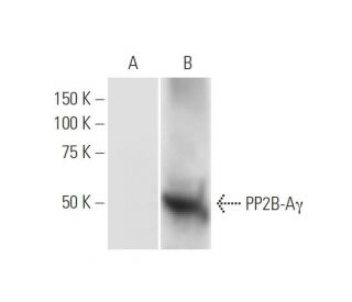 western blotting image from recommended PP2B-Aγ (4D1) monoclonal antibody replacement. Image 347568