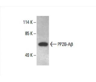 PP2B-Aβ Antibody (A-11) - Western Blotting - Image 392980Each CRISPR/Cas9 Knockout (KO) Plasmid product consists of a pool of 3 plasmids designed to ensure identification and cleavage of a specific gene for maximum knockout efficiency. Each plasmid encodes a unique 20 nt sequence derived from the GeCKO (v2) library.