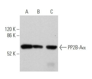 western blotting image from recommended PP2B-Aα (D-9) monoclonal antibody replacement. Image 373532