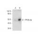 PP2B-Aβ Antibody (A-11) - Western Blotting - Image 142713