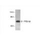 western blotting image from recommended PP2B-Aβ (A-11) monoclonal antibody replacement. Image 392980