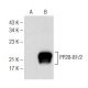 PP2B-B1/2 Antibody (D-1) - Western Blotting - Image 148842