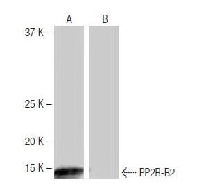 PP2B-B2 Antibody (MH-94) - Western Blotting - Image 65039
