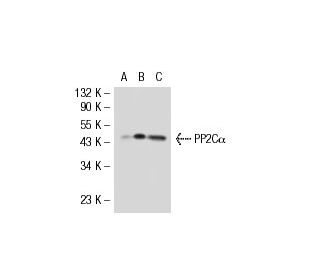 PP2C&alpha; Antibody (6D708) - Western Blotting - Image 30020 