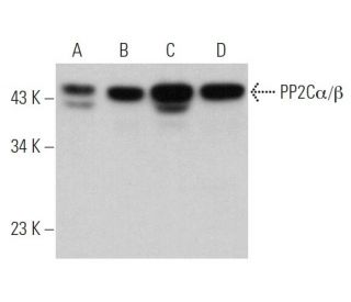 PP2C&alpha;/&beta; Antibody (D-8) - Western Blotting - Image 360669 