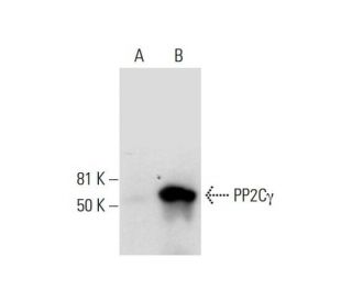 PP2C&gamma; Antibody (G-11) - Western Blotting - Image 291857