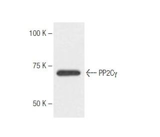 PP2C&gamma; Antibody (k1G6) - Western Blotting - Image 62765 