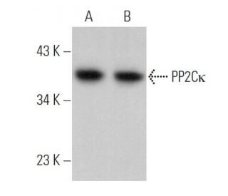 PP2C&kappa; Antibody (E-8) - Western Blotting - Image 375974 