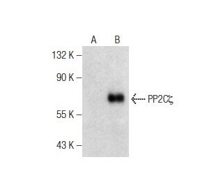 PP2C&zeta; Antibody (D-4) - Western Blotting - Image 286902