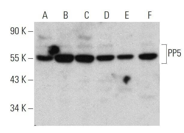 PP5 Antibody (F-12) | SCBT - Santa Cruz Biotechnology