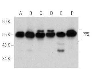 PP5 Antibody (H-7) - Western Blotting - Image 359386 