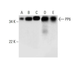 PP6抗体(E-2) | SCBT - Santa Cruz Biotechnology