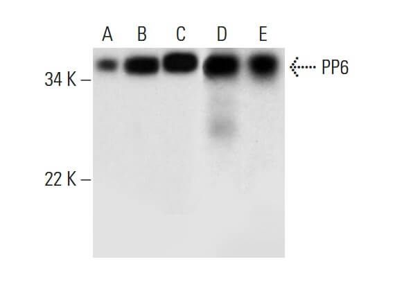 PP6 Antibody (E-2) | SCBT - Santa Cruz Biotechnology