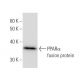 PPARα Antibody (467D1a) - Western Blotting - Image 47864