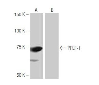PPEF-1/PP7/PPEF1 Antibody (SW-67) - Western Blotting - Image 65040