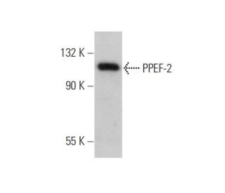 PPEF-2 Antibody (41) - Western Blotting - Image 346971