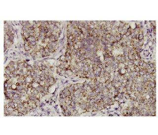 PPOX Antibody (42J-6) - Immunohistochemistry - Image 36074 