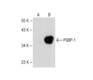 PQBP-1 Antibody (B-9) - Western Blotting - Image 149573 