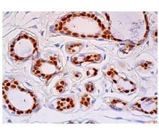 Progesterone Receptor Antibody (2C11F11) - Immunohistochemistry - Image 324392 