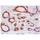 Progesterone Receptor Antibody (2C11F11) - Immunohistochemistry - Image 324392 