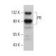 Progesterone Receptor Antibody (2C11F11) - Western Blotting - Image 379052