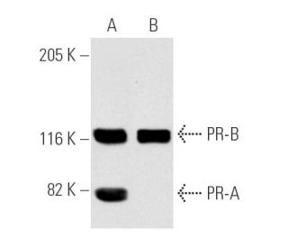 Progesterone Receptor Antibody (AB-52) - Western Blotting - Image 1599 