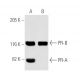 Progesterone Receptor Antibody (AB-52) - Western Blotting - Image 1599 