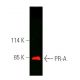 Progesterone Receptor Antibody (AB-52) - Western Blotting - Image 390269