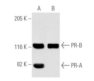 Progesterone Receptor Antibody (B-30) | Santa Cruz Animal Health