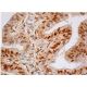 immunohistochemistry image from recommended Progesterone Receptor (F-4) monoclonal antibody replacement. Image 354990