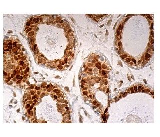 Progesterone Receptor Antibody (F-4) | SCBT - Santa Cruz Biotechnology