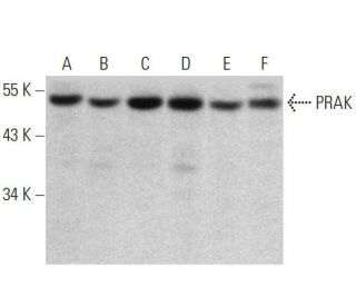 PRAK Antibody (A-7) - Western Blotting - Image 358731 