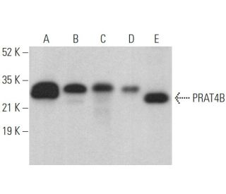 PRAT4B Antibody (E-10) - Western Blotting - Image 372039 
