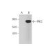 PRCC Antibody (D-3) - Western Blotting - Image 289494