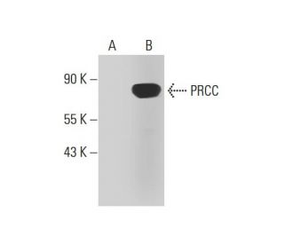 PRCC Antibody (D-3) - Western Blotting - Image 289494SAM Transcription Activation: SAM system utilizing dCas9-VP64, MS2-P65-HSF1, and sgRNA for precise gene transcription activation.