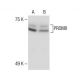 PRDM8 Antibody (E-3) - Western Blotting - Image 285145