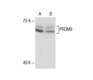 PRDM8 Antibody (E-3) - Western Blotting - Image 285145Each CRISPR/Cas9 Knockout (KO) Plasmid product consists of a pool of 3 plasmids designed to ensure identification and cleavage of a specific gene for maximum knockout efficiency. Each plasmid encodes a unique 20 nt sequence derived from the GeCKO (v2) library.