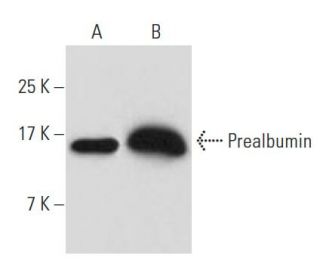 Prealbumin Antibody (10E1) - Western Blotting - Image 62796