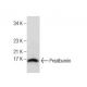 western blotting image from recommended Prealbumin (E-1) monoclonal antibody replacement. Image 158356