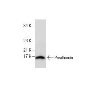 western blotting image from recommended Prealbumin (E-1) monoclonal antibody replacement. Image 158356
