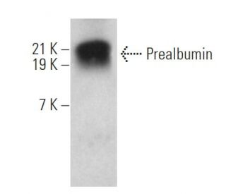 Prealbumin Antibody (E-4) - Western Blotting - Image 362076