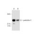 prefoldin 3 Antibody (D-5) - Western Blotting - Image 289456