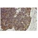 prefoldin 3 Antibody (YY-3Q) - Immunohistochemistry - Image 36174