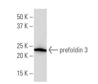 prefoldin 3 Antibody (YY-3Q) - Western Blotting - Image 34190 