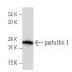 prefoldin 3 Antibody (YY-3Q) - Western Blotting - Image 34190 